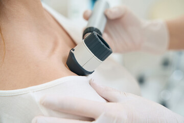 Diagnosis of neoplasms, moles with a dermatoscope, close-up