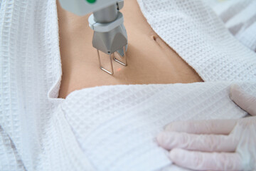 Laser removal of neoplasms is a non-surgical method for removing skin formations