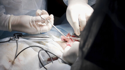 Close up of professional surgeons sewing up an open wound during medical procedure. Action. Doctors in clean uniform using catgut to finish surgery.