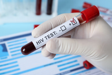 Scientist holding tube with blood sample and label HIV Test near laboratory form, closeup - obrazy, fototapety, plakaty