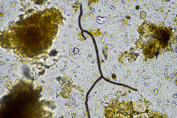 soil microbes organisms in a soil and compost sample, fungus and fungi and under the microscope in...