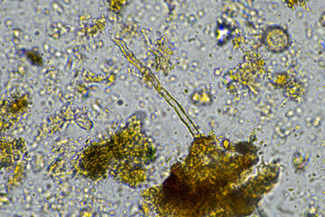 soil microbes organisms in a soil and compost sample, fungus and fungi and under the microscope in...