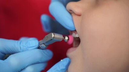 Child dentist makes professional teeth cleaning in dentistry close-up. 4k video. Professional hygiene for teeth of child in dentistry. Pediatric dentist examines kid patient in dentistry.