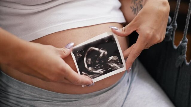 Printed ultrasound picture of a head of a baby during pregnancy. Proud caucasian pregnant mother showing USG photo in front of her bare pregnant belly. High quality 4k footage