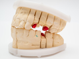 Plaster model or cast of human teeth.