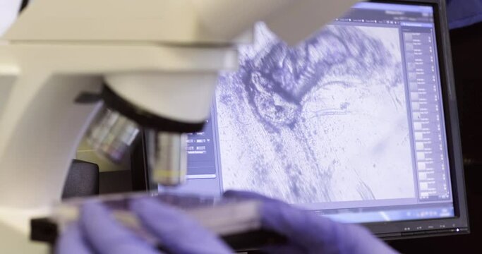 An enlarged live insect is displayed on the monitor of the microscope control panel, the scientist examines the insect under the magnification of the microscope in real time.