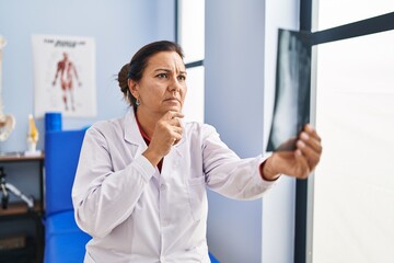 Fototapeta premium Middle age hispanic woman physiotherapist holding radiography at rehab clinic