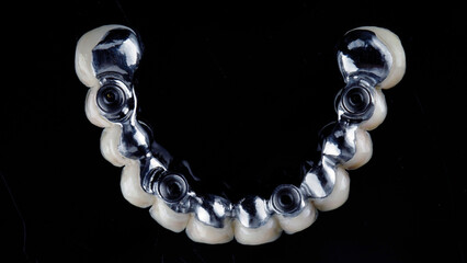 titanium dental bar in a ceramic prosthesis, top view on a black background