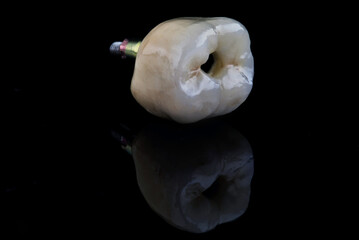 single dental crown and zircon on black glass with reflection