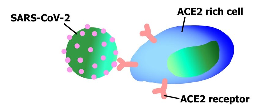 The pathologic mechanism of COVID 19 virus infection.