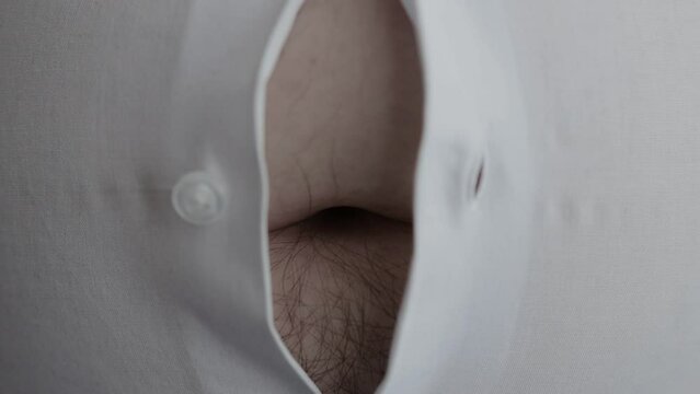 A tight white shirt is unbuttoned on the stomach of a fat man, close-up. Obesity and overweight. Problems with calories. Slow motion