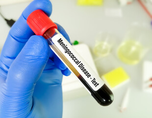 Blood sample for Meningococcal disease test, this disease caused by bacteria called Neisseria meningitidis. STDs