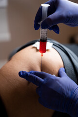 Eigenbluttherapie. Injektion in das Gesäß. Spritze