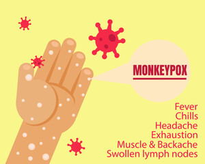 Monkeypox outbreak concept. Hands with virus. Cartoon vector style for your design.
