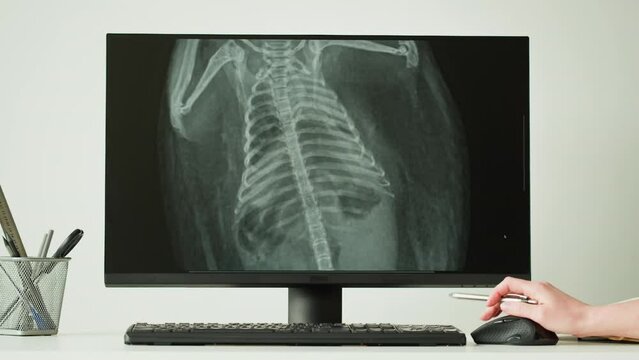 Doctor veterinarian examining hedgehog skeleton roentgen on computer monitor. Woman vet analyzing animal bones x-ray close-up. Healthcare and medicine concept.
