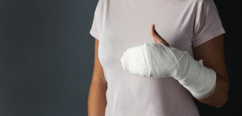 Woman with a cast on her arm showing thumbs up on the dark grey background. Girl has a broken hand...
