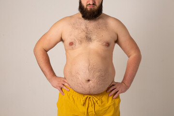 Millennial with obesity problem. Close-up of bearded young man with fat belly in yellow shorts...