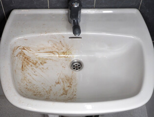 White ceramic sink before and after cleaning. Half washed