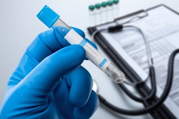 Blood sample tube for analysis Test. Blood tube test with requisition form