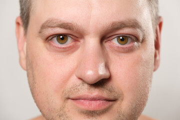 Obraz premium The face of a 36-year-old Caucasian man with a close-up of him looking into the camera.