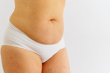 sagging skin with age spots on fat belly, plastic surgery concept