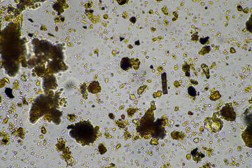 soil microbes organisms in a soil and compost sample, testate amoebae under the microscope in...