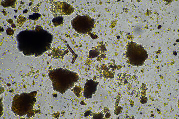 soil microbes organisms in a soil and compost sample, testate amoebae under the microscope in...