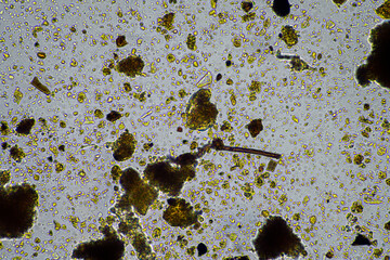 soil microbes organisms in a soil and compost sample, testate amoebae under the microscope in...