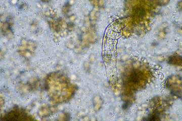 soil microbes organisms in a soil and compost sample, testate amoebae under the microscope in regenerative agriculture. in australia.