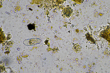 soil microbes organisms in a soil and compost sample, testate amoebae under the microscope in...