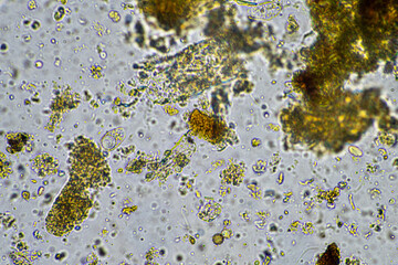 soil microbes organisms in a soil and compost sample, fungus and fungi and under the microscope in...