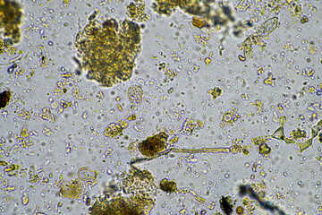 soil microbes organisms in a soil and compost sample, fungus and fungi and under the microscope in regenerative agriculture. in australia.
