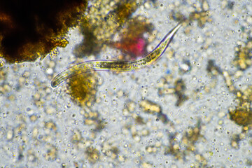 soil microbes organisms in a soil and compost sample, fungus and fungi and under the microscope in...