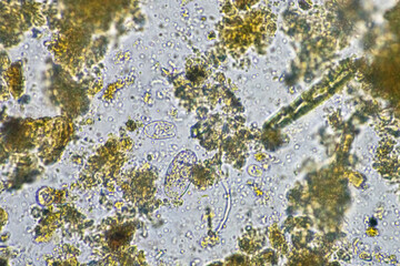 soil microbes organisms in a soil and compost sample, fungus and fungi and under the microscope in regenerative agriculture. in australia.
