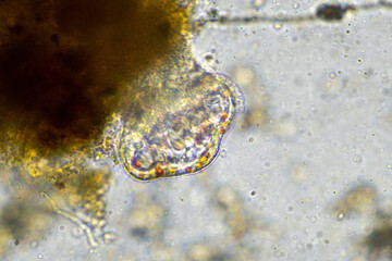 soil microbes organisms in a soil and compost sample, fungus and fungi and under the microscope in...