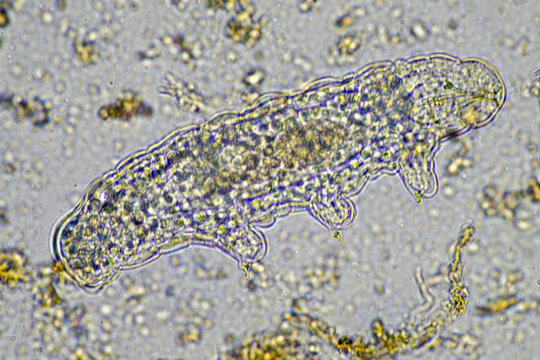 microorganisms and a tardigrade in a soil sample on a farm 