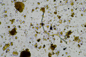 microorganisms living under the microscope