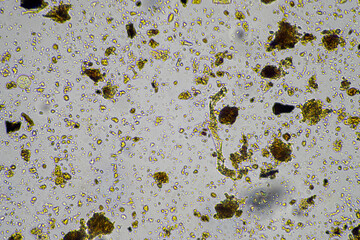 microorganisms living under the microscope