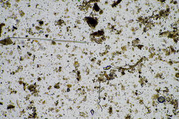 microorganisms living under the microscope