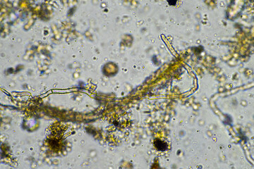 microorganisms living under the microscope
