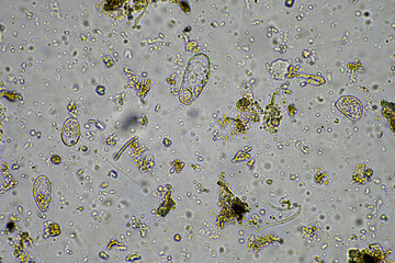 microorganisms living under the microscope
