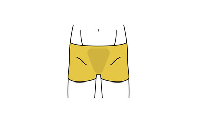 メンズ脱毛、Vライン、下着着用