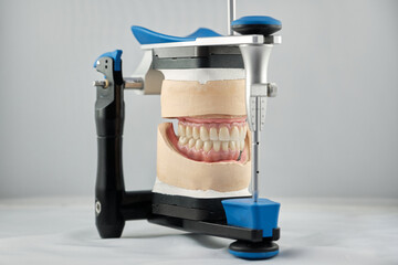 Dental photo of the articulator and two dental prostheses in the occlusion for accuracy and...