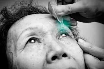 Close up of elder woman drips eye drops into her eyes with green spot on the drop. Black and white...