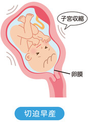 切迫早産　子宮の中の赤ちゃん　妊娠中の母体の仕組み