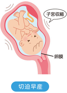 子宮口 Images Browse 91 Stock Photos Vectors And Video Adobe Stock