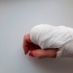 a woman's hand in a cast