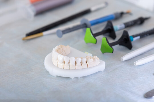 Equipment for dental procedure, cementation of laminate ceramic veneers