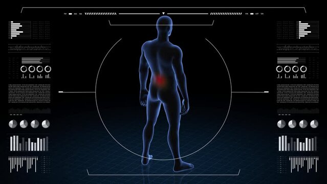 Man with pathology. 3d body of boy. Male human figure.
