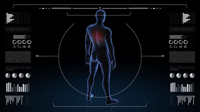 Man with pathology. 3d body of boy. Male human figure.